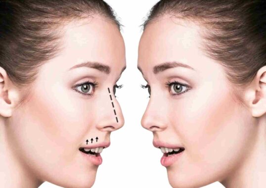 Rhinoplasty in Dubai