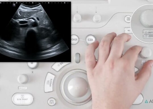 Important Facts About Getting Ultrasound Tests at Urgent Care Centers