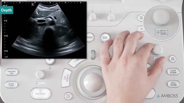 Important Facts About Getting Ultrasound Tests at Urgent Care Centers