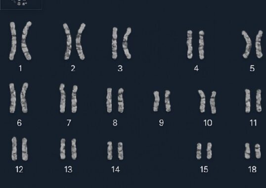 Karyotyping Software
