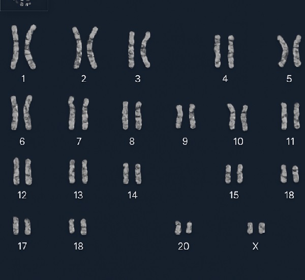 Karyotyping Software