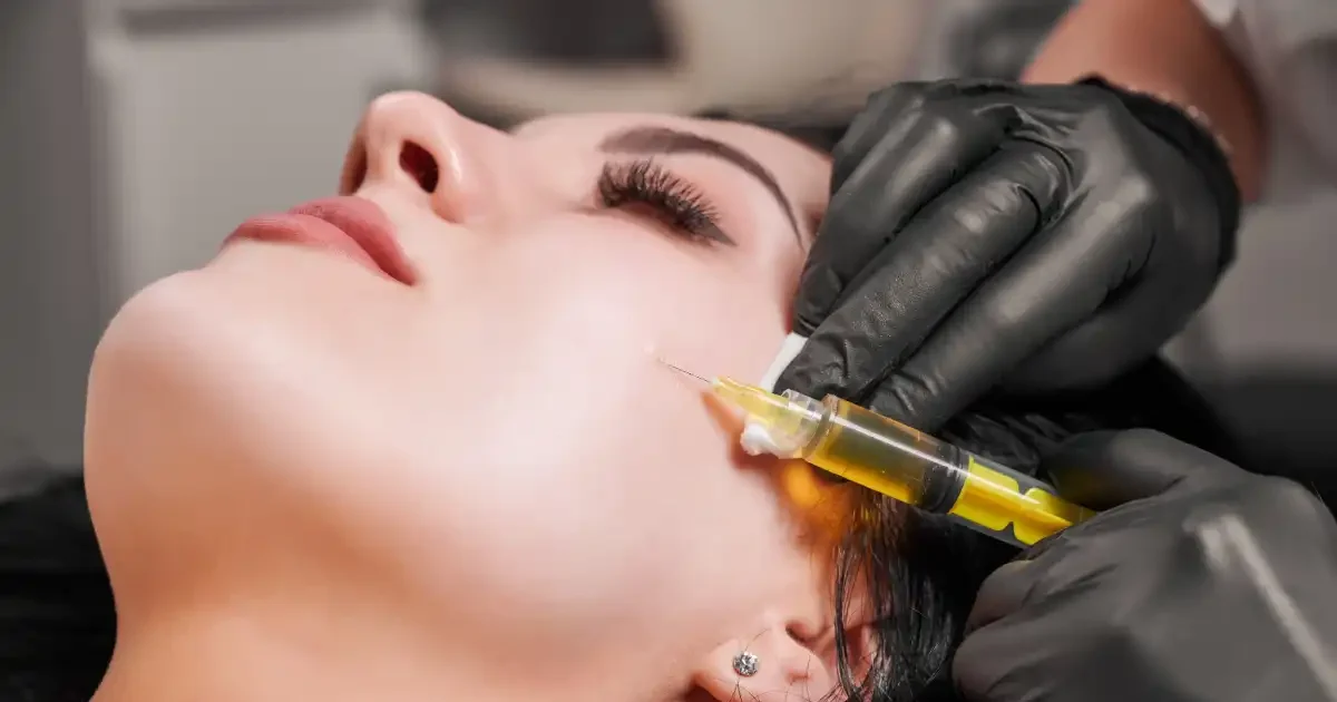 PRP Microneedling Toronto
