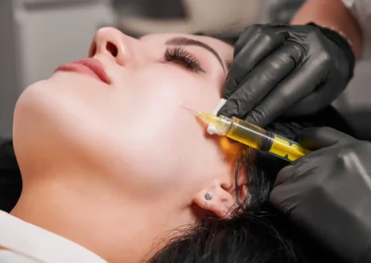 PRP Microneedling Toronto