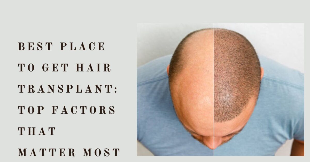 best place to get hair transplant