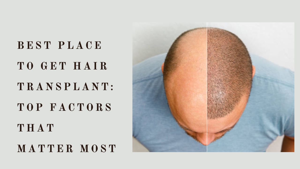 best place to get hair transplant
