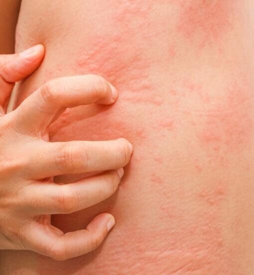 Generic Ciprofloxacin