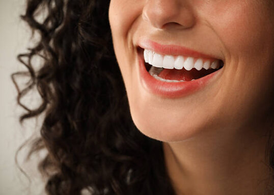 Teeth Whitening in Riyadh