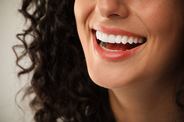 Teeth Whitening in Riyadh