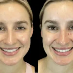 Best Aesthetic Clinic in Dubai