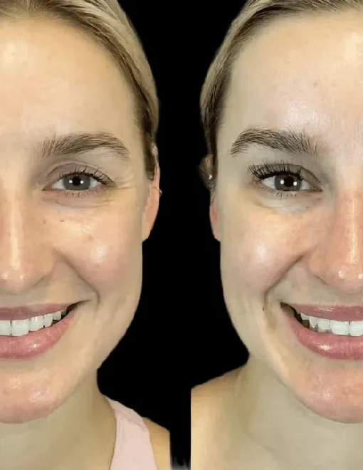 Best Aesthetic Clinic in Dubai