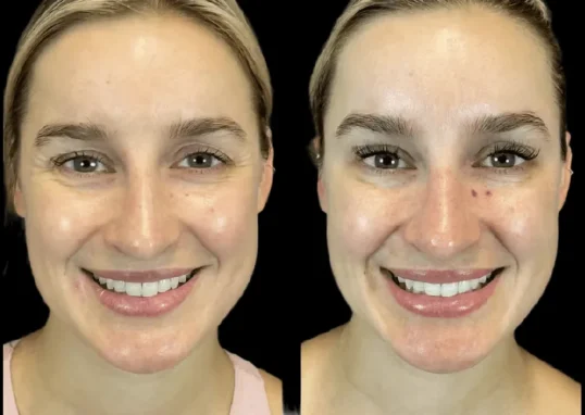 Best Aesthetic Clinic in Dubai