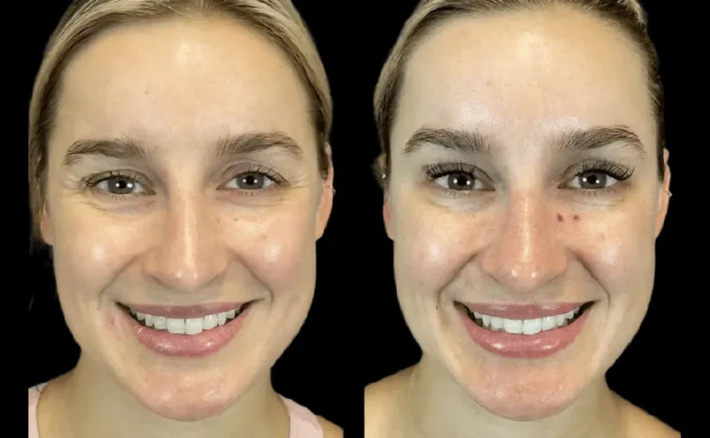 Best Aesthetic Clinic in Dubai